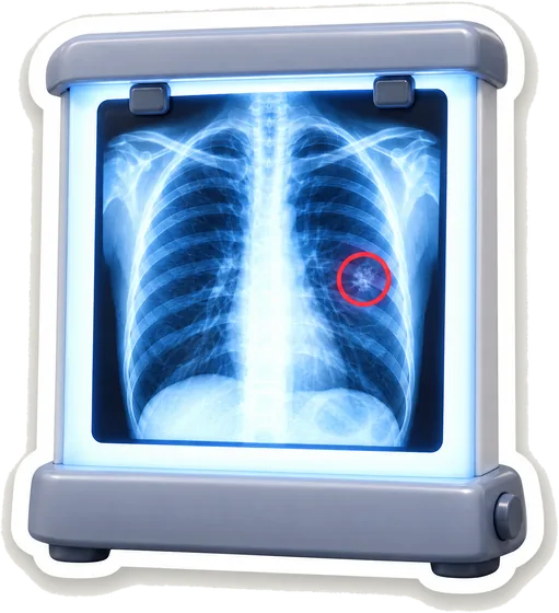 Imagerie médicale : une radio du thorax à lire